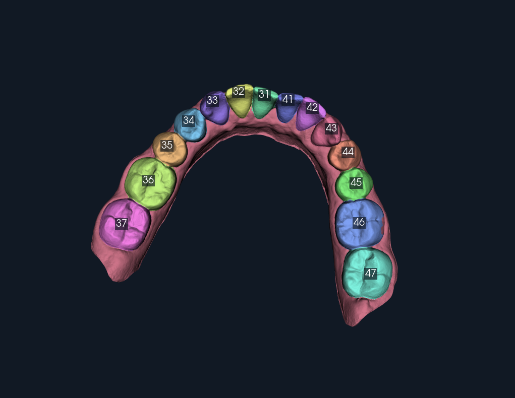 Tooth Studio viewport displaying a lower dental arch with coloured individual teeth and FDI number labels